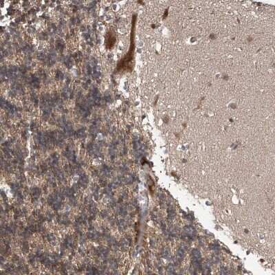 Immunohistochemistry: ABHD13 Antibody [NBP2-38205]