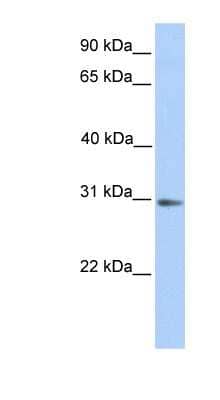 Western Blot: ABHD13 Antibody [NBP1-60026]