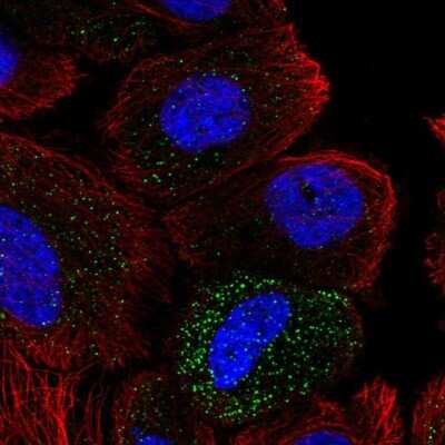 Immunocytochemistry/ Immunofluorescence: ABHD14A Antibody [NBP2-55281]