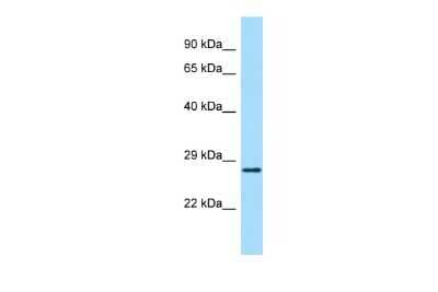 Western Blot: ABHD14A Antibody [NBP2-84374]