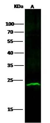 Western Blot: ABHD14B Antibody (011) [NBP2-90260]