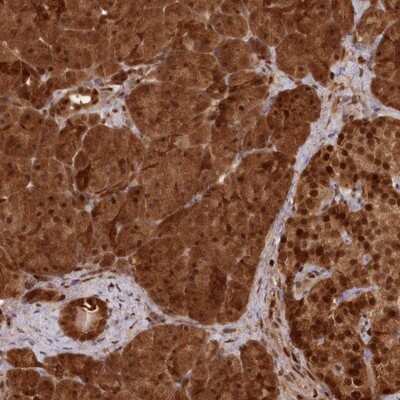 Immunohistochemistry-Paraffin: ABHD14B Antibody [NBP1-84472]