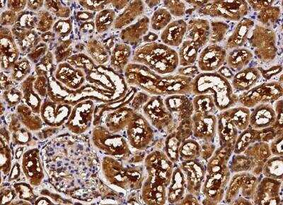 Immunohistochemistry-Paraffin: ABHD14B Antibody [NBP3-00217]