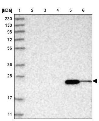 Western Blot: ABHD14B Antibody [NBP1-84472]