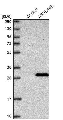 Western Blot: ABHD14B Antibody [NBP1-84473]