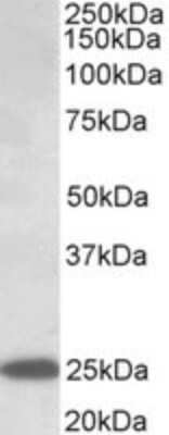 Western Blot: ABHD14B Antibody [NBP2-26122]