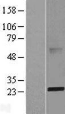 Western Blot: ABHD14B Overexpression Lysate [NBL1-07194]