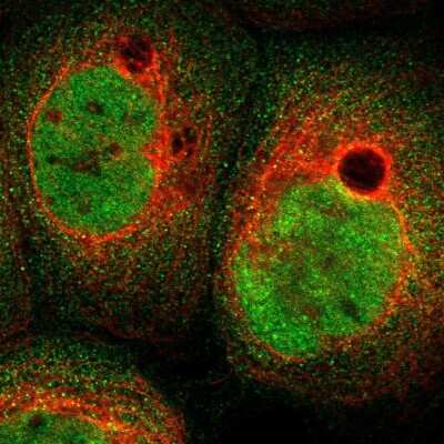 Immunocytochemistry/ Immunofluorescence: ABHD15 Antibody [NBP1-91100]