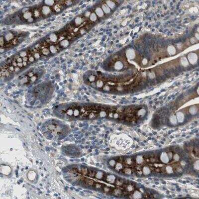 Immunohistochemistry: ABHD15 Antibody [NBP1-91100]