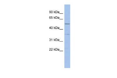 Western Blot: ABHD15 Antibody [NBP2-82548]