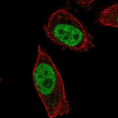 Immunocytochemistry/ Immunofluorescence: ABHD16B Antibody [NBP2-31761]