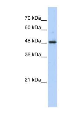 Western Blot: ABHD2 Antibody [NBP1-53199]