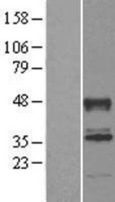 Western Blot: ABHD2 Overexpression Lysate [NBL1-07195]