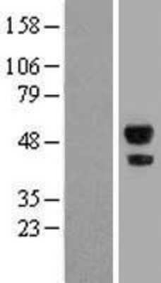 Western Blot: ABHD2 Overexpression Lysate [NBL1-07196]