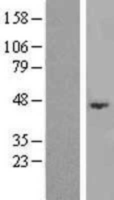 Western Blot: ABHD3 Overexpression Lysate [NBL1-07197]