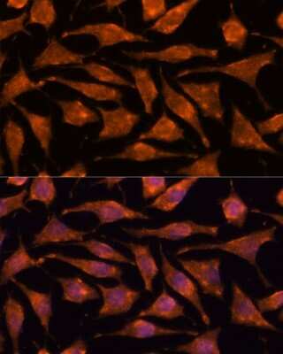 Immunocytochemistry/ Immunofluorescence: ABHD4 Antibody - Azide and BSA Free [NBP3-15550]