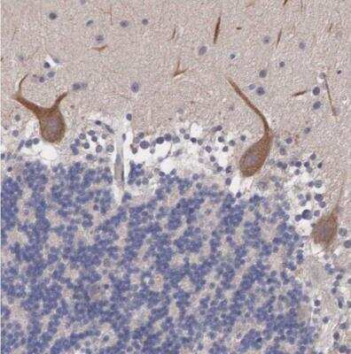Immunohistochemistry-Paraffin: ABHD4 Antibody [NBP1-83711]