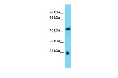 Western Blot: ABHD4 Antibody [NBP2-84378]