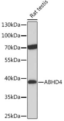 Western Blot: ABHD4 AntibodyAzide and BSA Free [NBP3-15550]