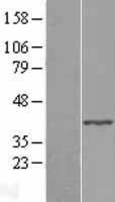 Western Blot: ABHD4 Overexpression Lysate [NBL1-07198]