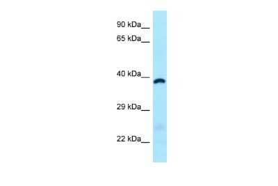 Western Blot: ABHD6 Antibody [NBP2-82552]