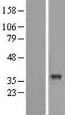 Western Blot: ABHD6 Overexpression Lysate [NBL1-07200]