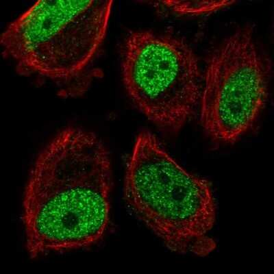 Immunocytochemistry/ Immunofluorescence: ABHD8 Antibody [NBP2-55079]