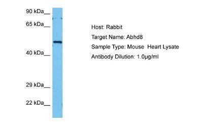 Western Blot: ABHD8 Antibody [NBP2-84379]