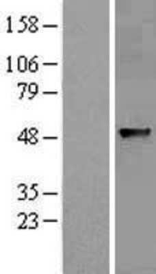 Western Blot: ABHD8 Overexpression Lysate [NBL1-07202]