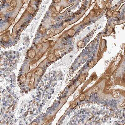 Immunohistochemistry: ABHD9 Antibody [NBP1-90290]