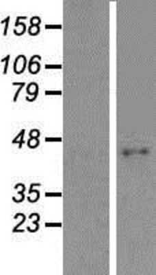 Western Blot: ABHD9 Overexpression Lysate [NBP2-06283]