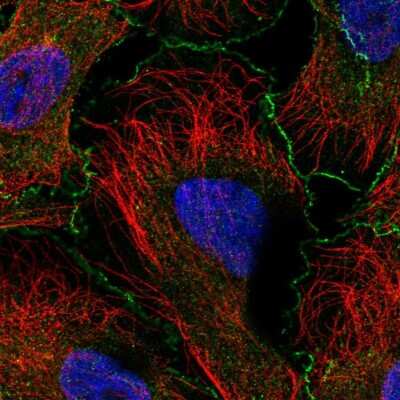 Immunocytochemistry/ Immunofluorescence: ABI1 Antibody [NBP2-57842]