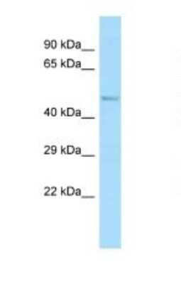 Western Blot: ABI1 Antibody [NBP1-98306]