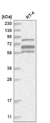 Western Blot: ABI1 Antibody [NBP2-56144]