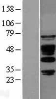 Western Blot: ABI1 Overexpression Lysate [NBL1-07203]