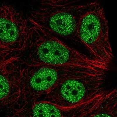 Immunocytochemistry/ Immunofluorescence: ABI2 Antibody [NBP2-56014]