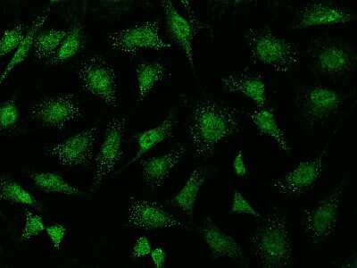 Immunocytochemistry/ Immunofluorescence: ABI2 Antibody [NBP2-99345]