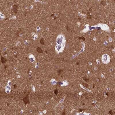 Immunohistochemistry-Paraffin: ABI2 Antibody [NBP2-49637]