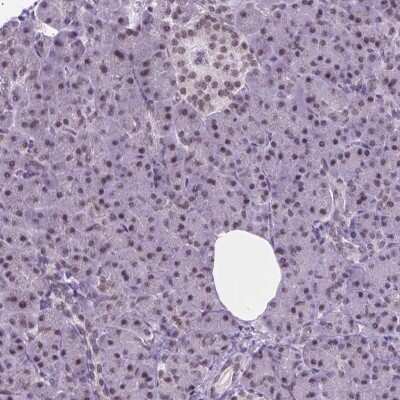 Immunohistochemistry-Paraffin: ABI2 Antibody [NBP2-49637]