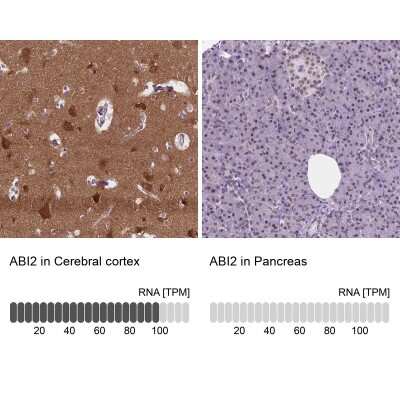 Immunohistochemistry-Paraffin: ABI2 Antibody [NBP2-49637]