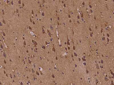 Immunohistochemistry-Paraffin: ABI2 Antibody [NBP2-98107]