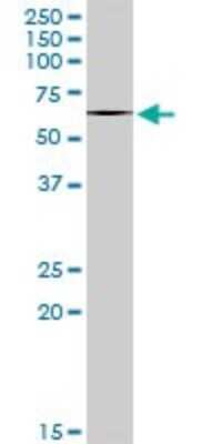 Western Blot: ABI2 Antibody [H00010152-B01P]