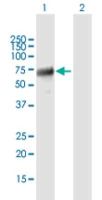 Western Blot: ABI2 Antibody [H00010152-B01P]