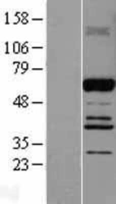 Western Blot: ABI2 Overexpression Lysate [NBL1-07205]