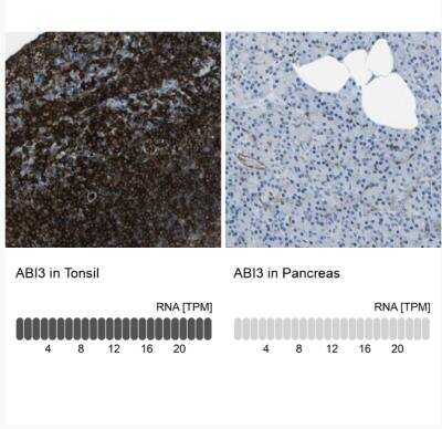 Immunohistochemistry-Paraffin: ABI3 Antibody [NBP2-30583]