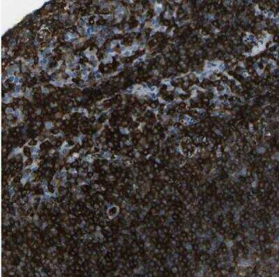 Immunohistochemistry-Paraffin: ABI3 Antibody [NBP2-30583]