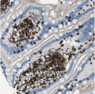 Immunohistochemistry-Paraffin: ABI3 Antibody [NBP2-30583]