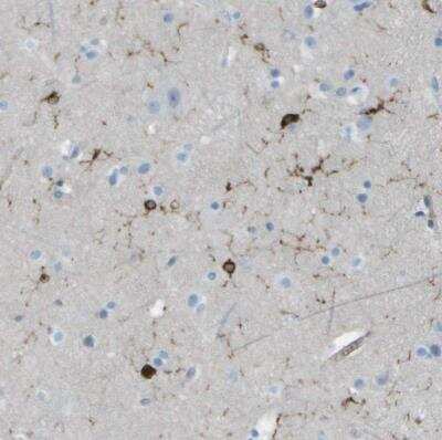 Immunohistochemistry-Paraffin: ABI3 Antibody [NBP2-30583]