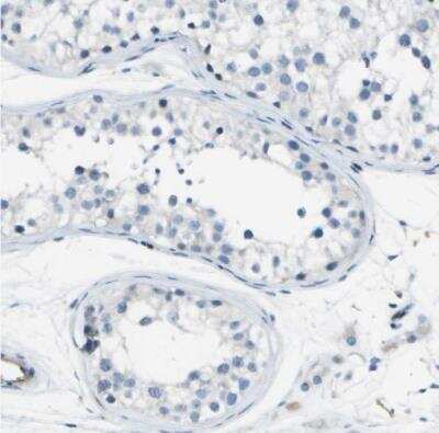 Immunohistochemistry-Paraffin: ABI3 Antibody [NBP2-30583]