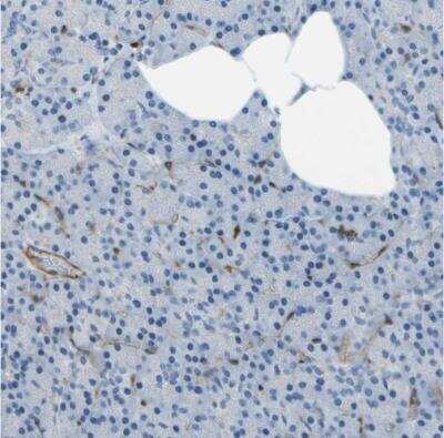 Immunohistochemistry-Paraffin: ABI3 Antibody [NBP2-30583]